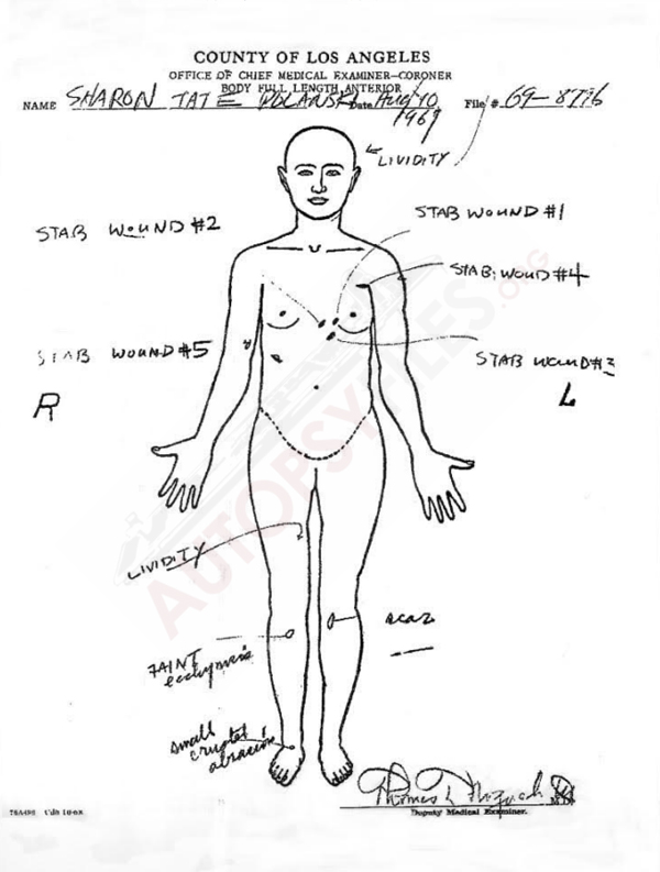 sharon tate autopsy bilder sharon tate autopsy bilder